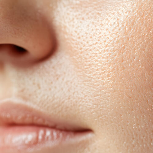 Pores dilatés à Lausanne