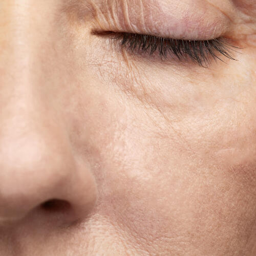 Peau terne à Lausanne