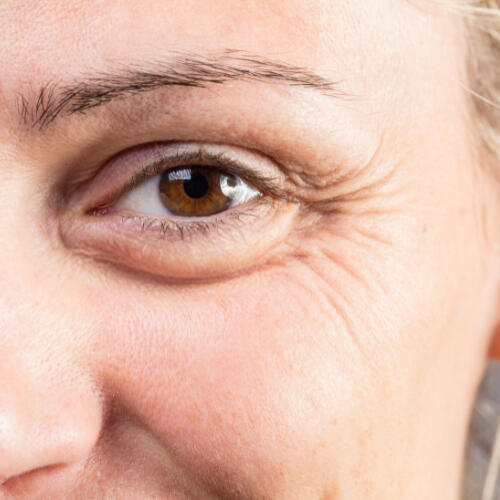 Rides et ridules à Lausanne Rides et ridules à Lausanne